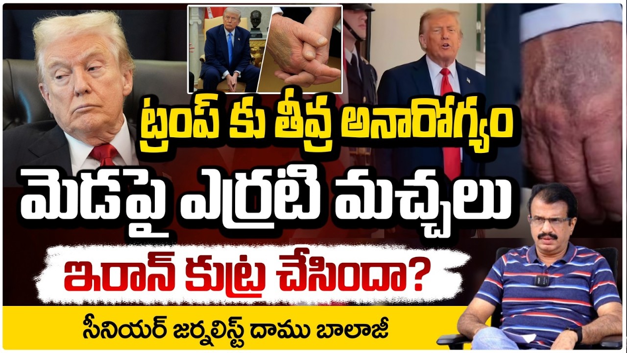 ట్రంప్ కు తీవ్ర అనారోగ్యం! | Donald Trump health condition Latest Update | Daamu Balaji