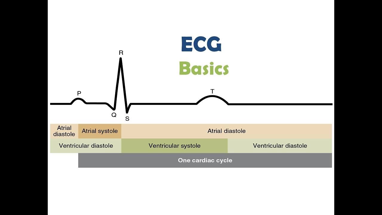 ECG- Basics