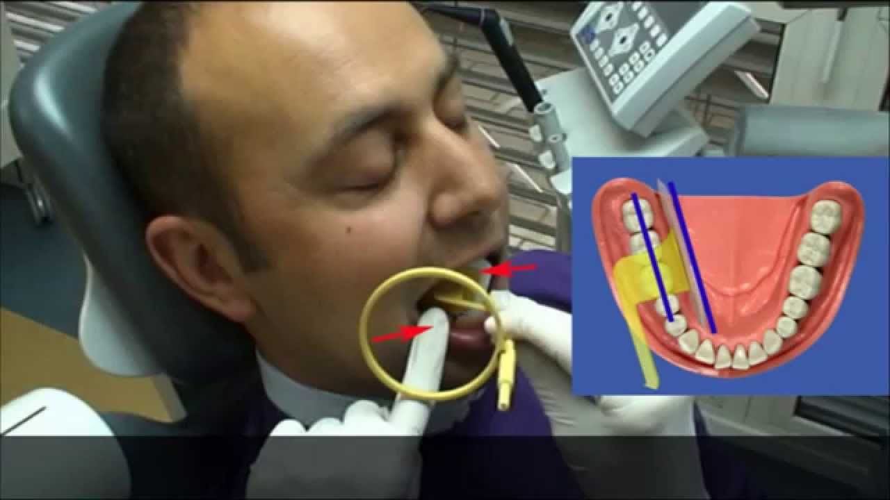 Kwik Bite movie (EN)