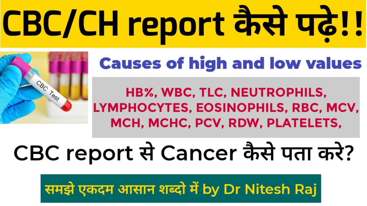 CBC report कैसे पढ़े!!रिपोर्ट देख के बिमारी का पता कैसे करें !! By Drniteshraj