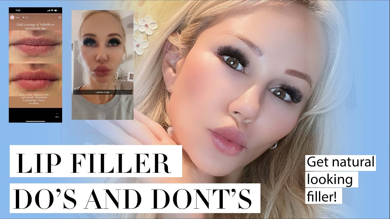 How to get NATURAL looking LIP FILLER! Avoid duck lips with these tips from a cosmetic dermatologist