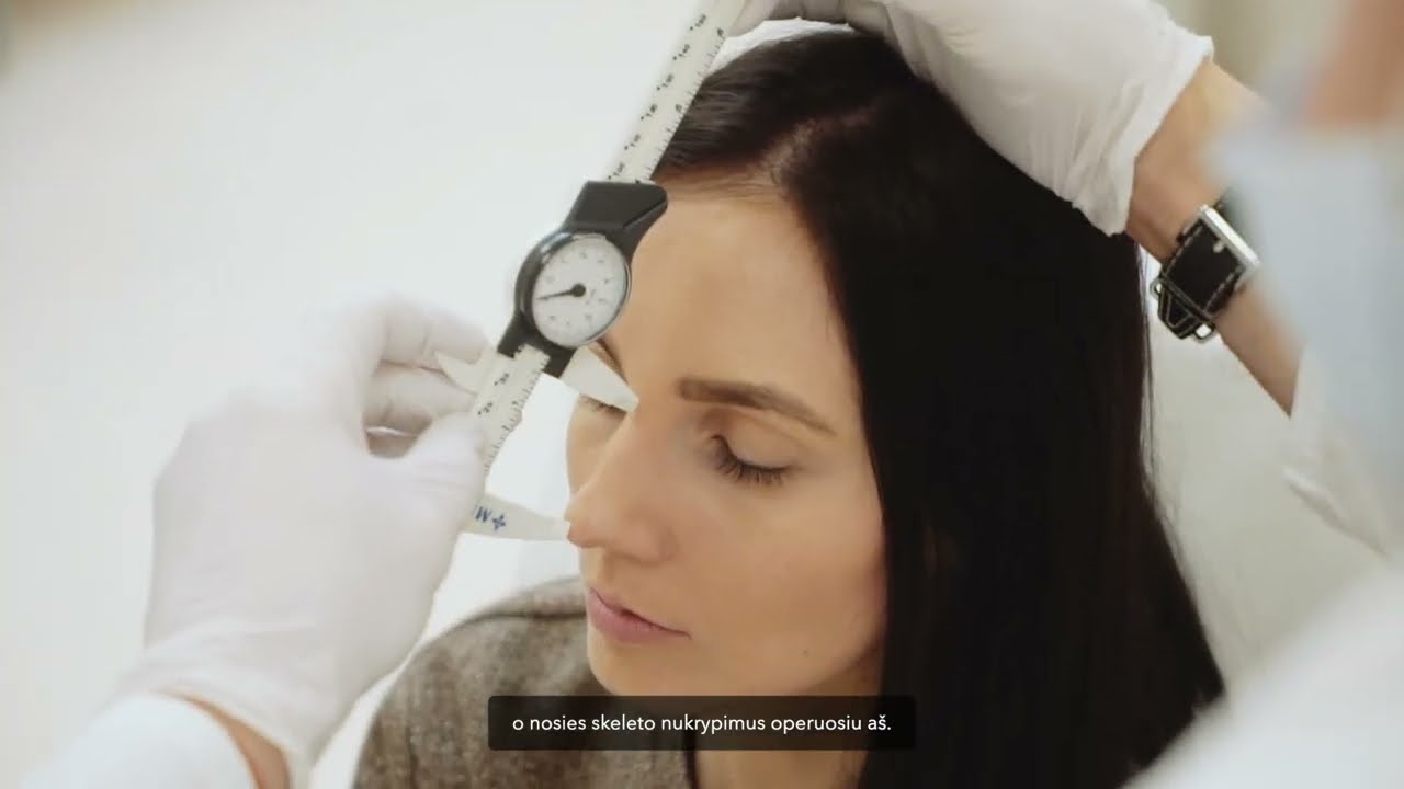 Rinoplastika. Nosies plastinė operacija: prieš ir po