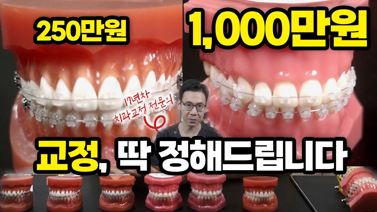 다양한 치아교정 장치! 내 치아에 맞는 장치는 따로 있다고?