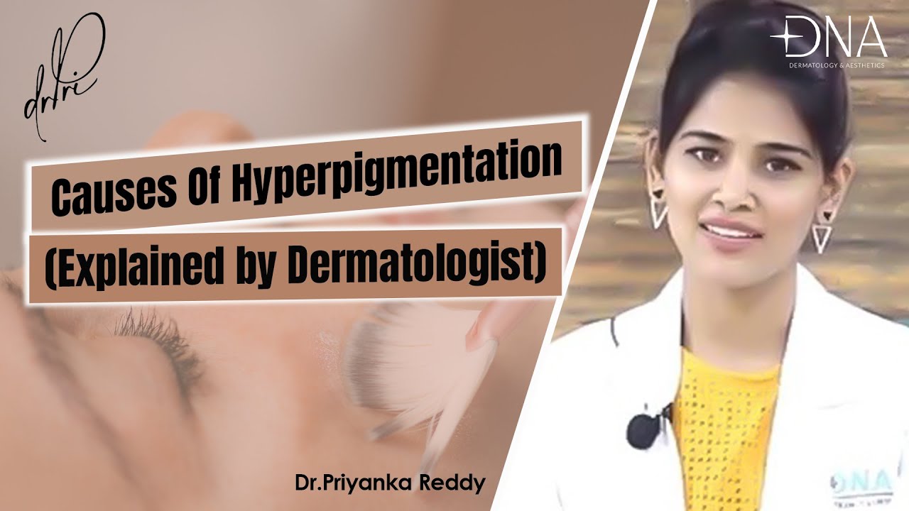 Causes of Facial Hyperpigmentation | Dark Spots on Face | Dr. Priyanka Reddy | DNA Skin Clinic