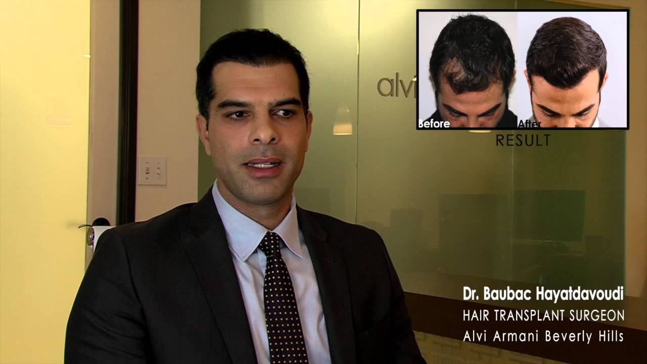 Best Hair Transplant Clinic in Los Angeles &ndash; Alvi Armani Beverly Hills