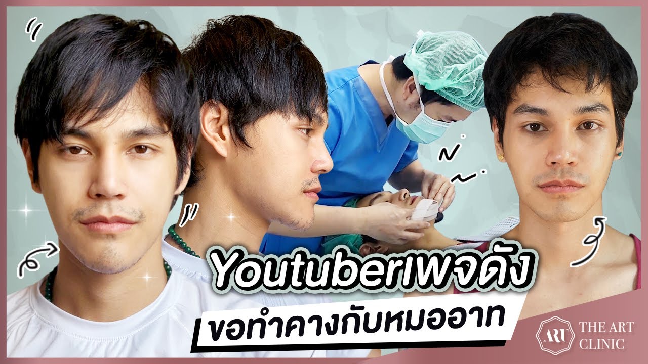 รีวิวเสริมคางผู้ชายที่ดีที่สุด : คางทรงนี้ หมออาทออกแบบเองที่ The Art Clinic