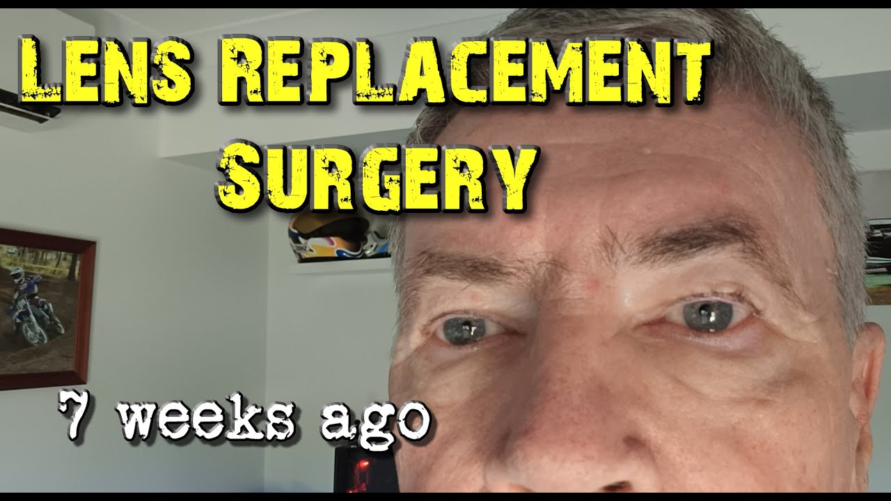 Lens replacement surgery 7 weeks on