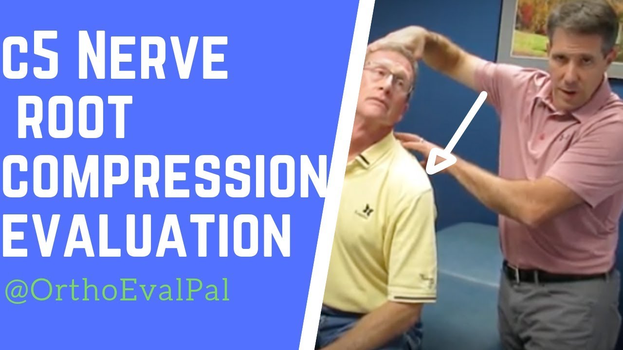 C5 Nerve Root Compression Evaluation