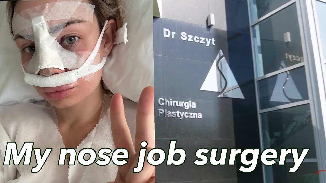OPERACJA NOSA W KLINICE DR. SZCZYTA💉 🙊 NOSE JOB IN POLAND