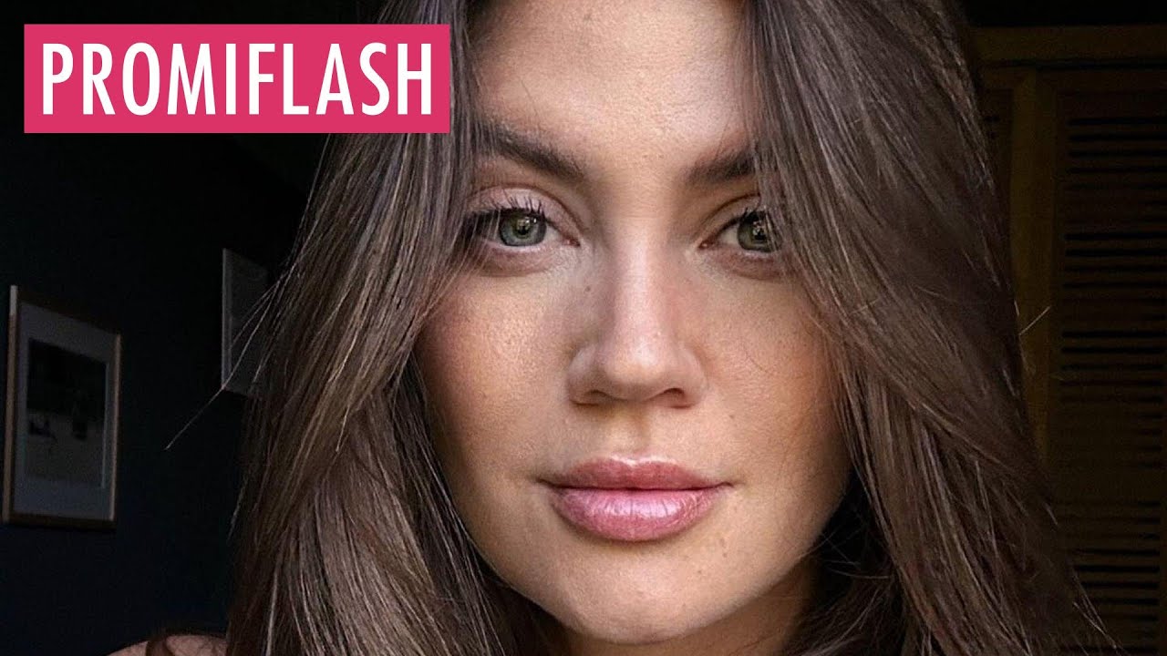 Gehirn-Aneurysma: Not-OP bei Ex-Bachelorette Nadine Klein
