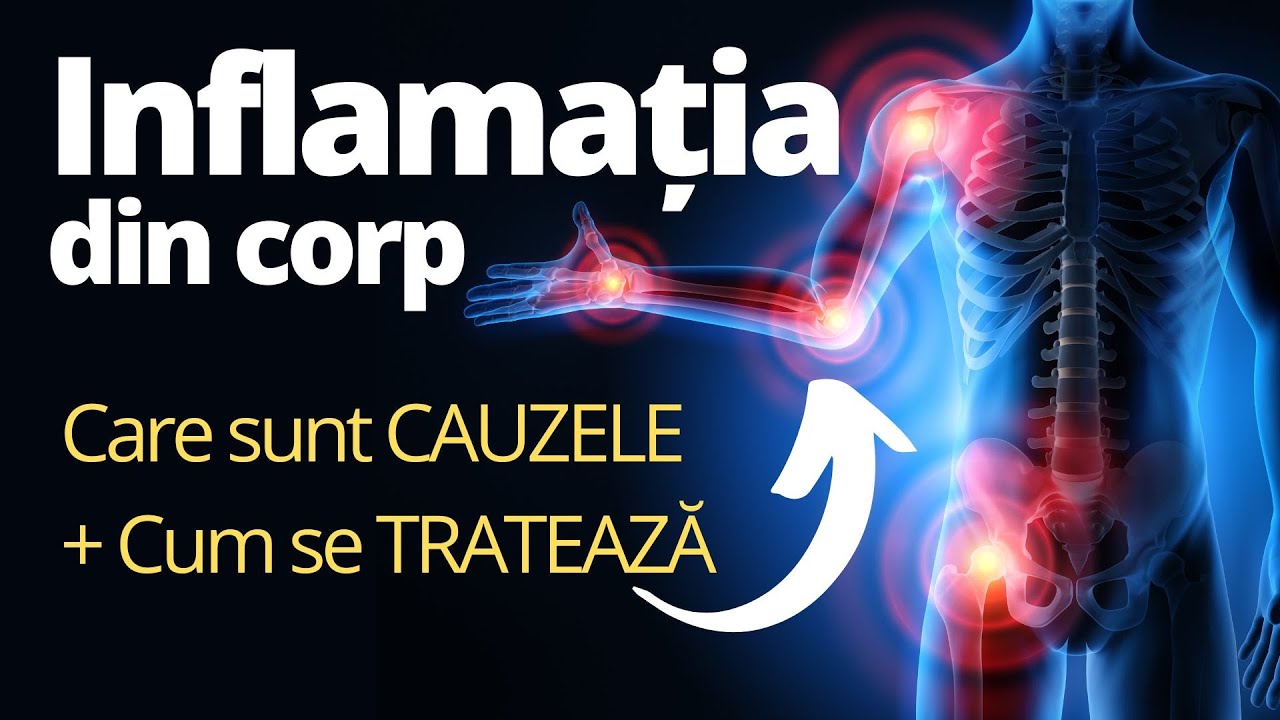 De ce apare INFLAMAȚIA în corp. Tratamentul explicat
