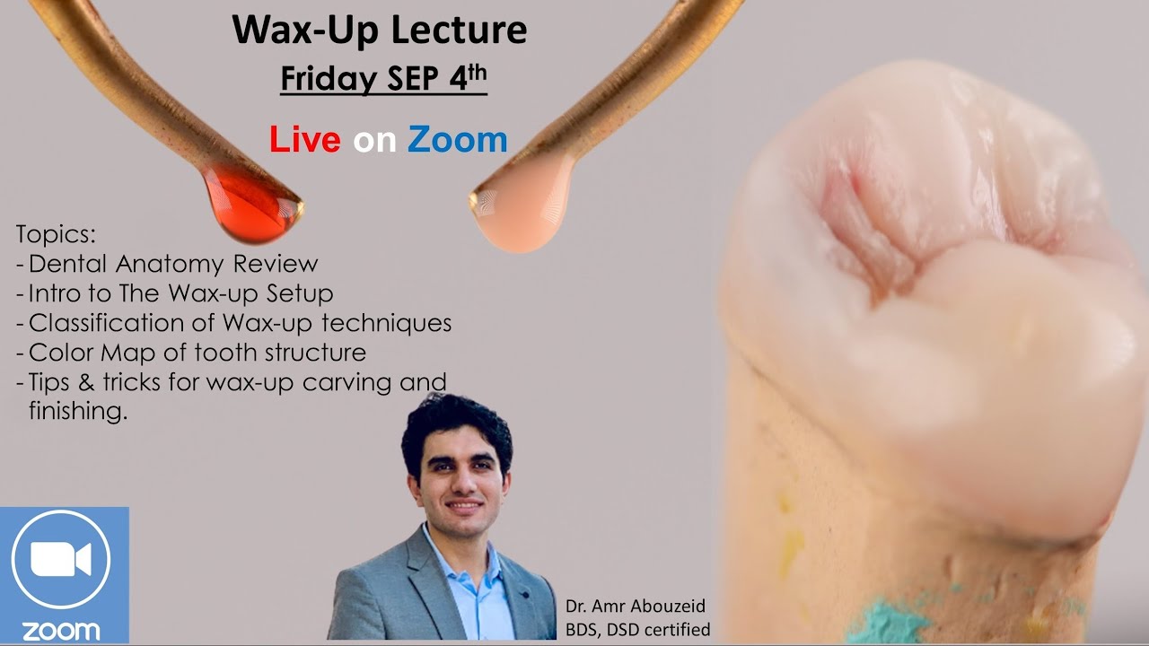 Wax-Up Lecture By Dr. Amr Abouzeid