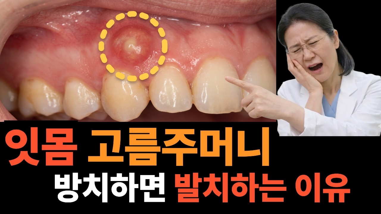치아 뿌리염증 잇몸 혹 고름주머니 원인과 해결법