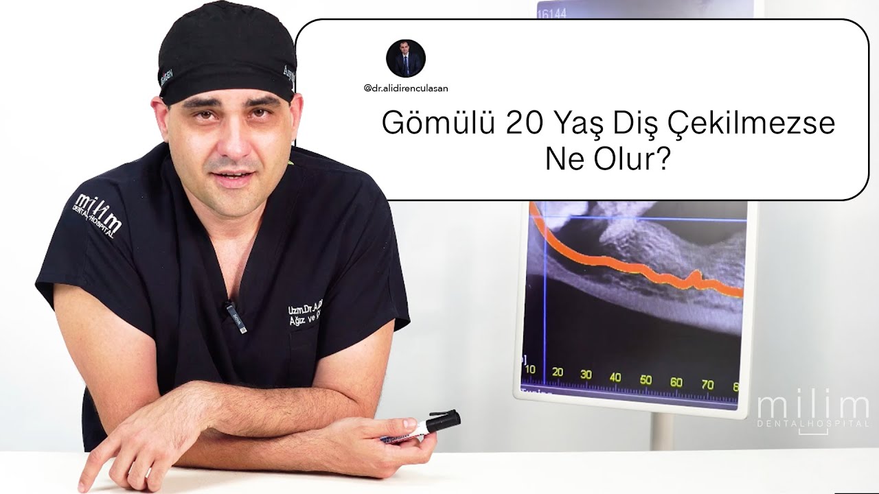 Gömülü 20 Yaş Dişi Çekilmezse Ne Olur? - Çene Cerrahı Anlatıyor