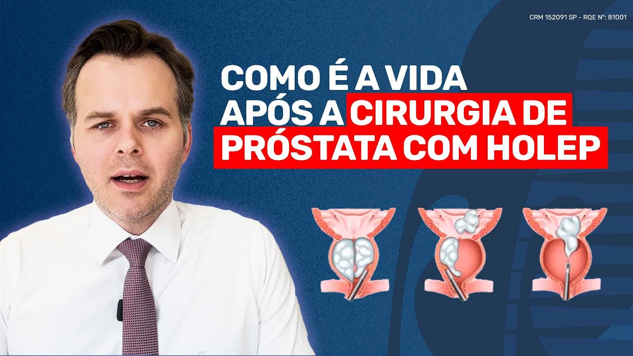 RESULTADOS CIRURGIA DE PRÓSTATA HOLEP | O QUE ESPERAR SOBRE RECUPERAÇÃO - EXPLICAÇÃO UROLOGISTA