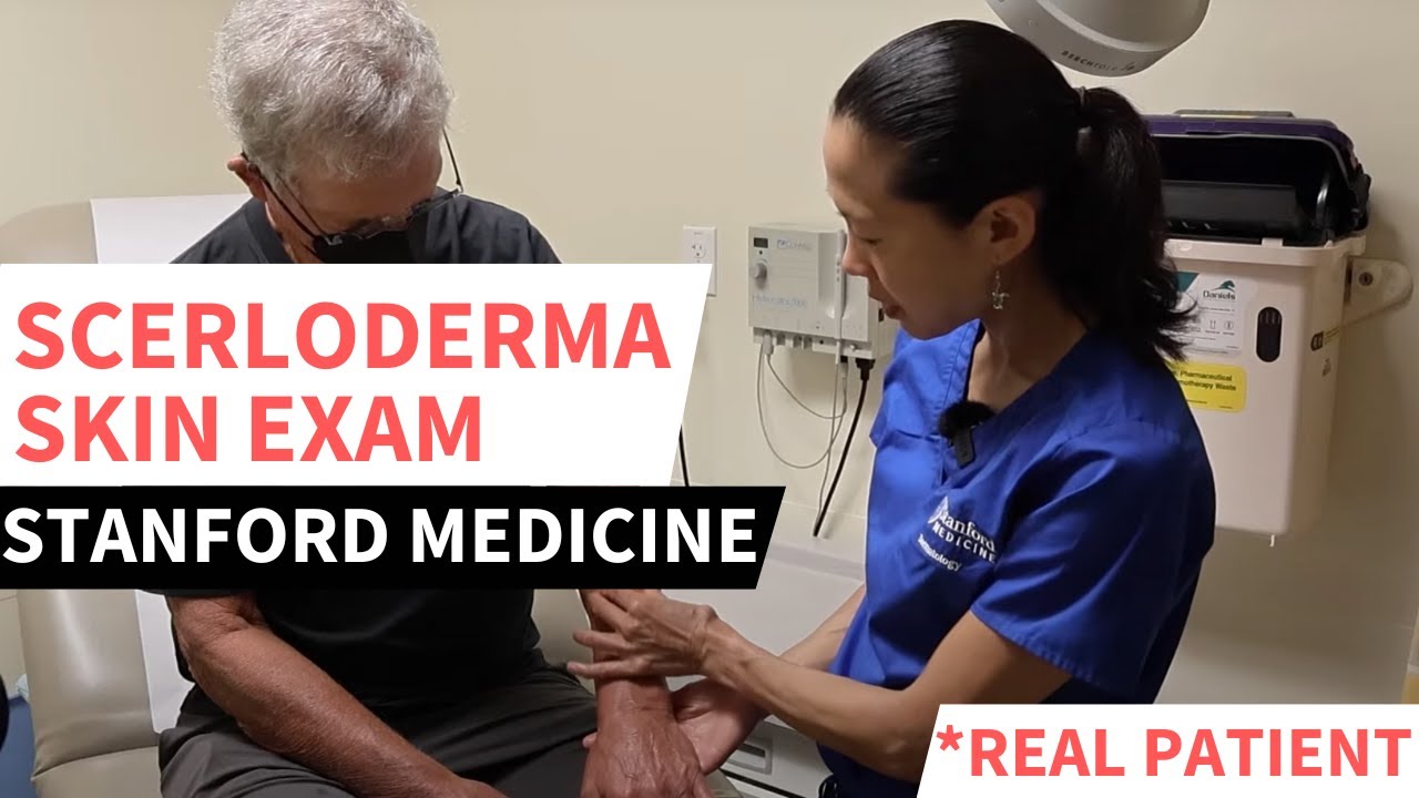 Scleroderma Step-By-Step Skin Exam