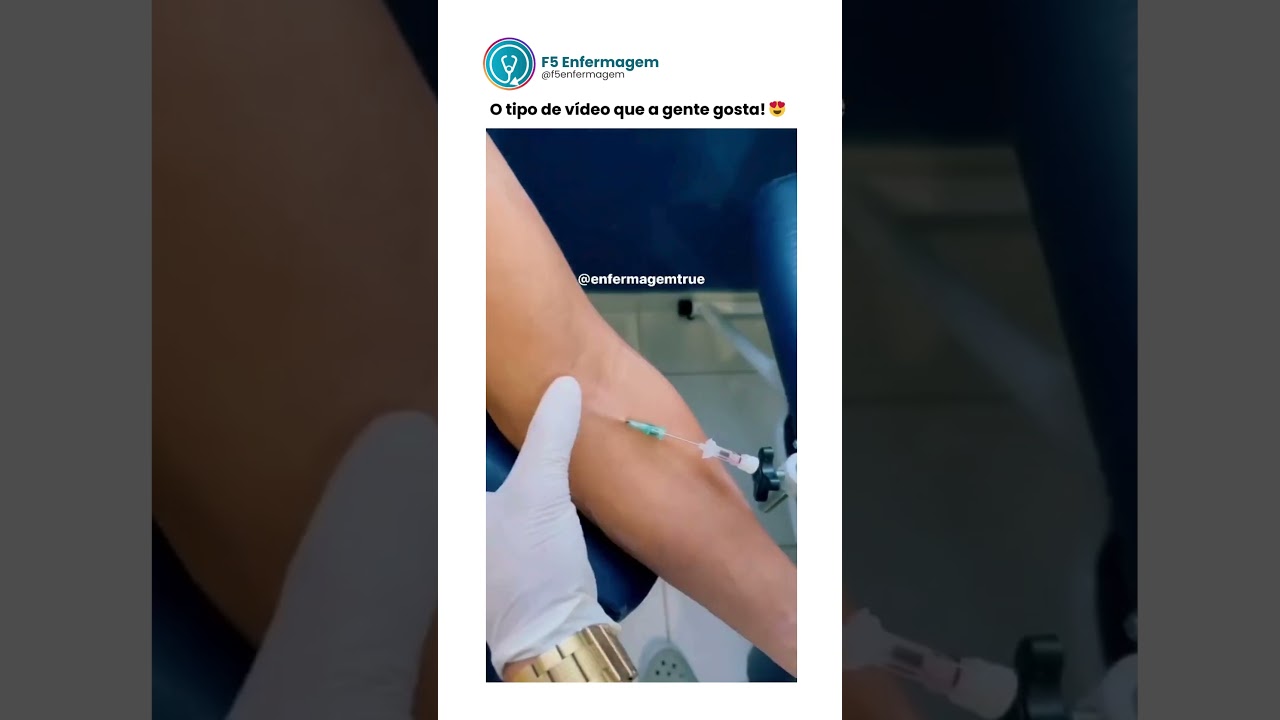 Pun&ccedil;&atilde;o Venosa