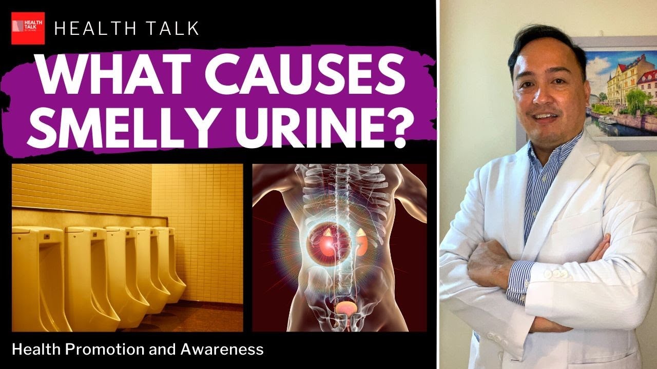 What causes smelly urine? Ano ang dahilan bakit kakaibang amoy ang ating ihi?