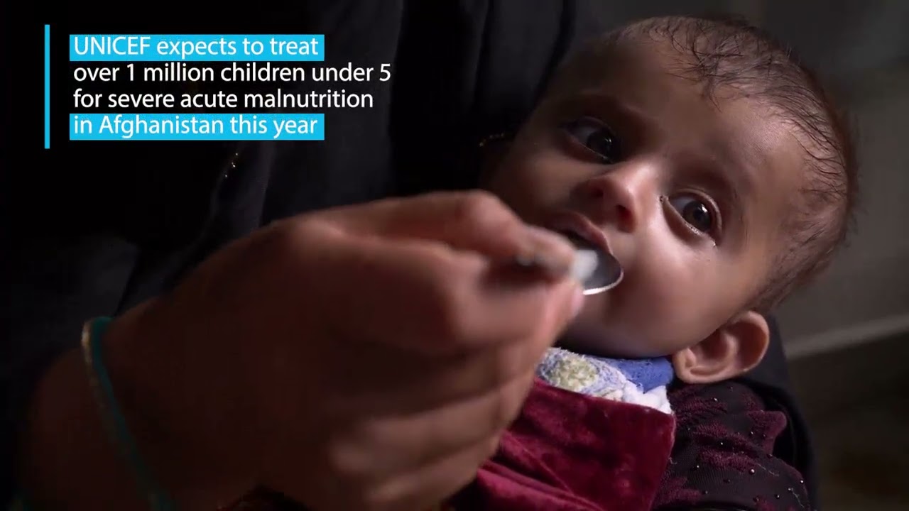 Malnourished children in Afghanistan