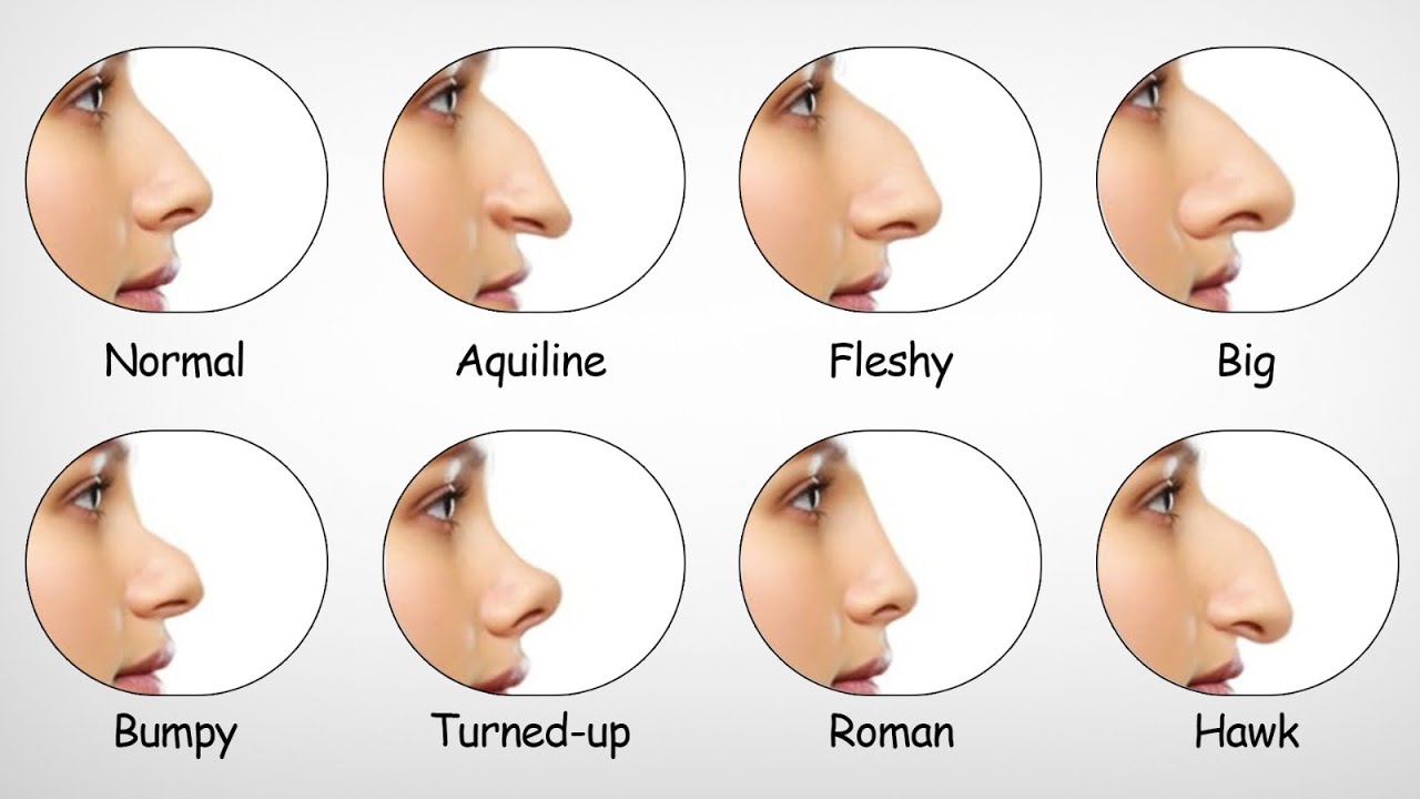 Every Type of Nose Job — What You Really Need to Know in 20 Mins