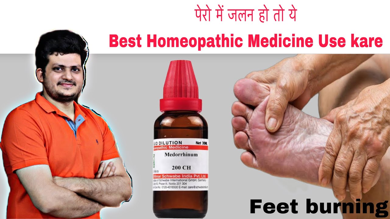 तलवे और पैरों में जलन | Feet Burning | best Homeopathic Medicine | how to use |