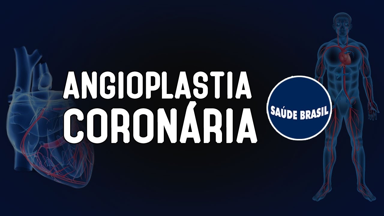 ANGIOPLASTIA CORONÁRIA | SÉRIE SAÚDE BRASIL
