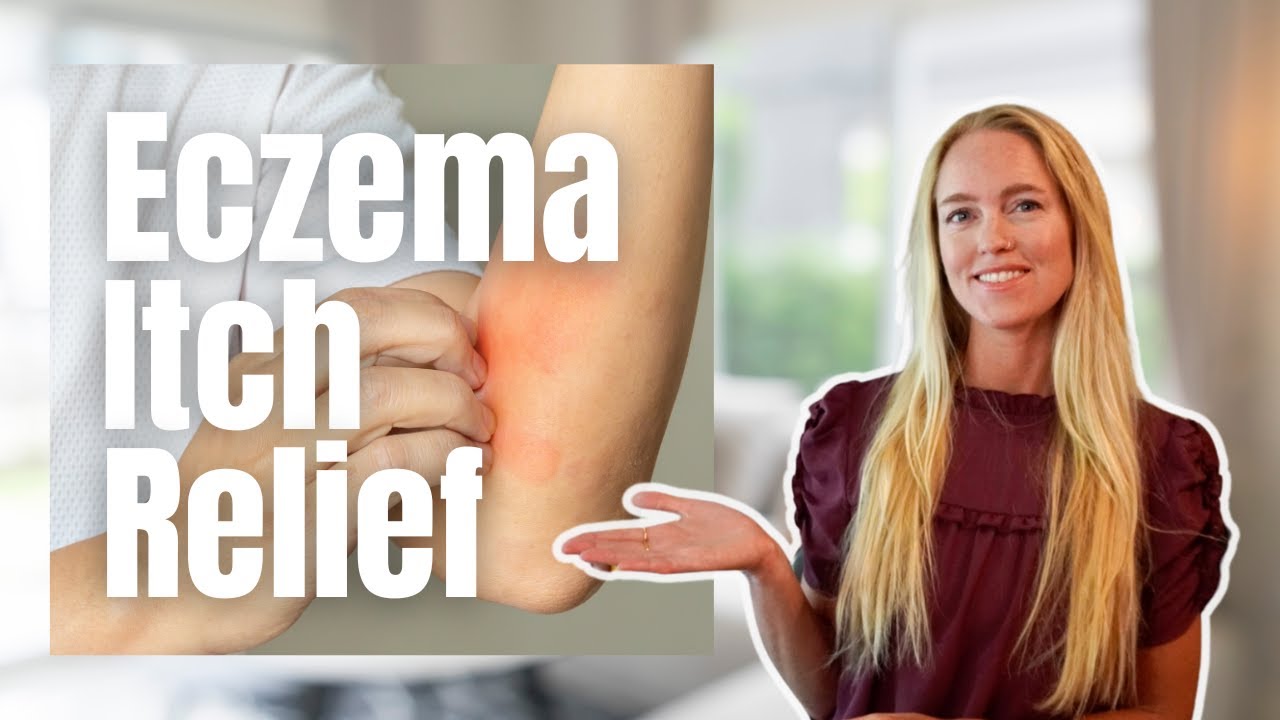 How To Get Relief From Eczema Itching | Tips to Reduce the Itch!