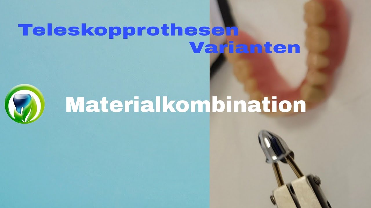 Teleskopprothesen Varianten - gaumenfrei, Modellguss, Gaumenplatte, Coverdenture, Teleskopbrücke