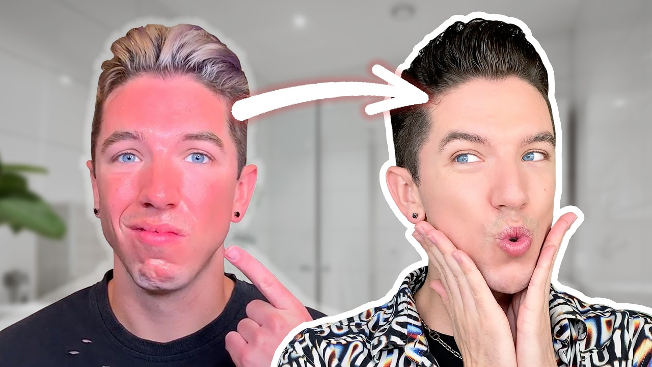 How to Heal Your Sensitive Skin 🔴 The Best Products of 2024