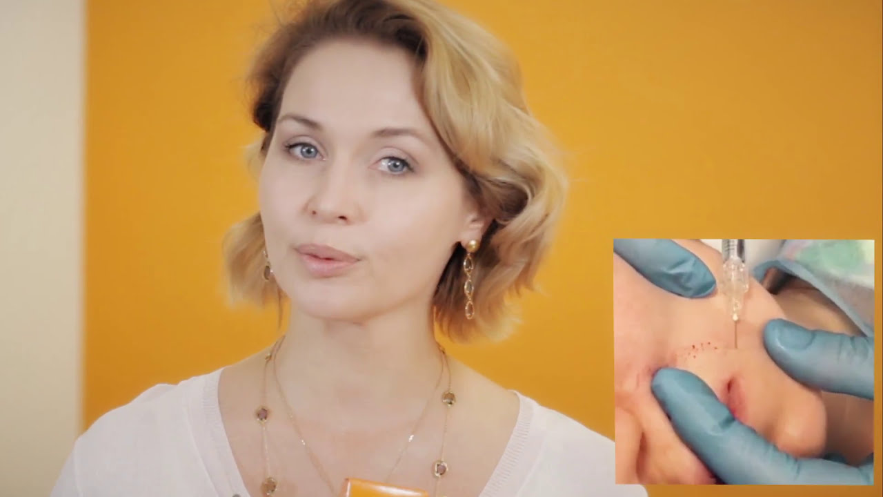 Belotero Soft и Balance для техники 