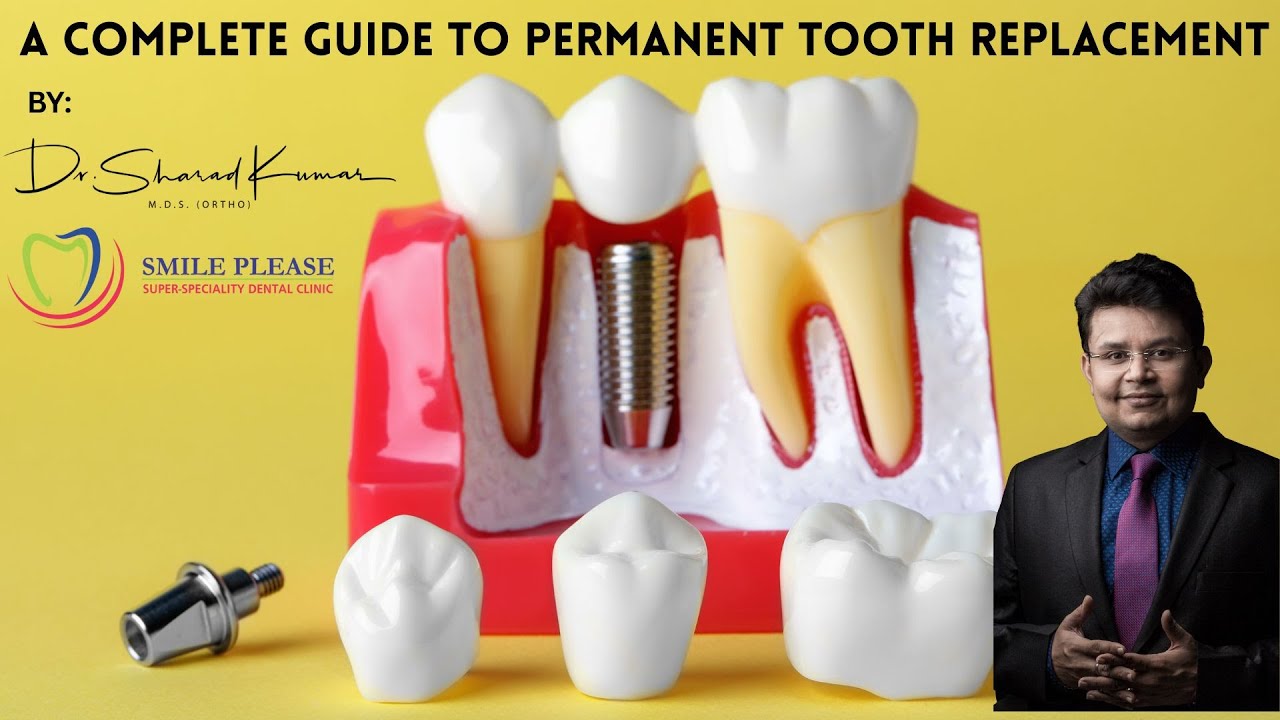 Dental Implants Explained | Best Fixed Tooth Replacement in Navi Mumbai