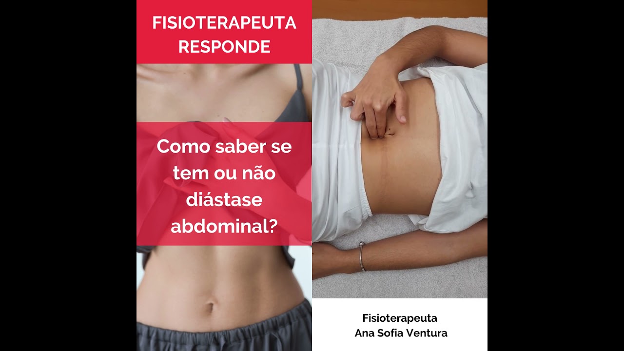 Como saber se tem ou n&atilde;o di&aacute;stase abdominal?