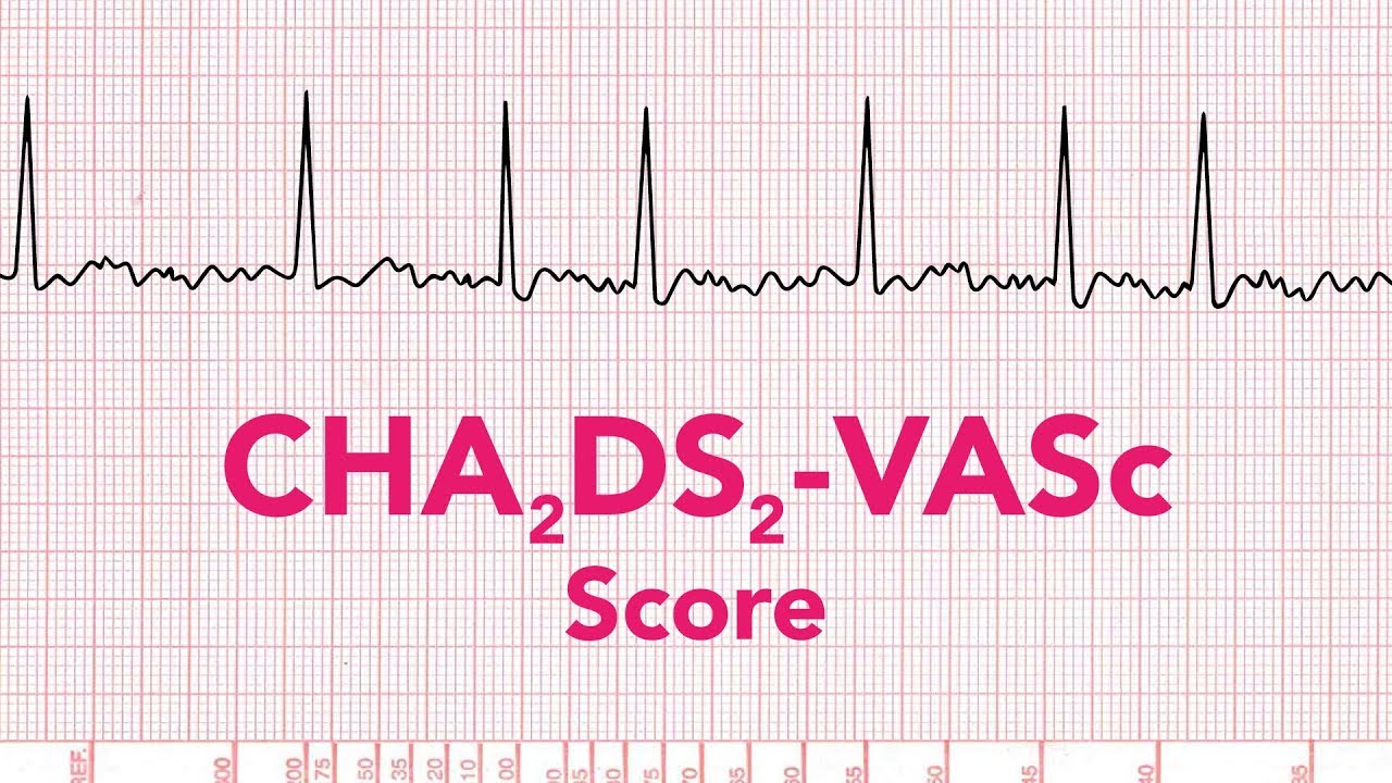 Оценка фибрилляции предсердий по шкале CHADS-VASc — MEDZCOOL