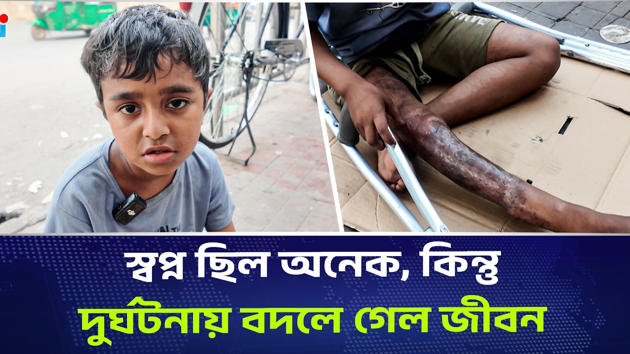 স্বপ্ন ছিল অনেক, কিন্তু দুর্ঘটনায় বদলে গেল ইয়াসিনের জীবন | DHAKA PRESS