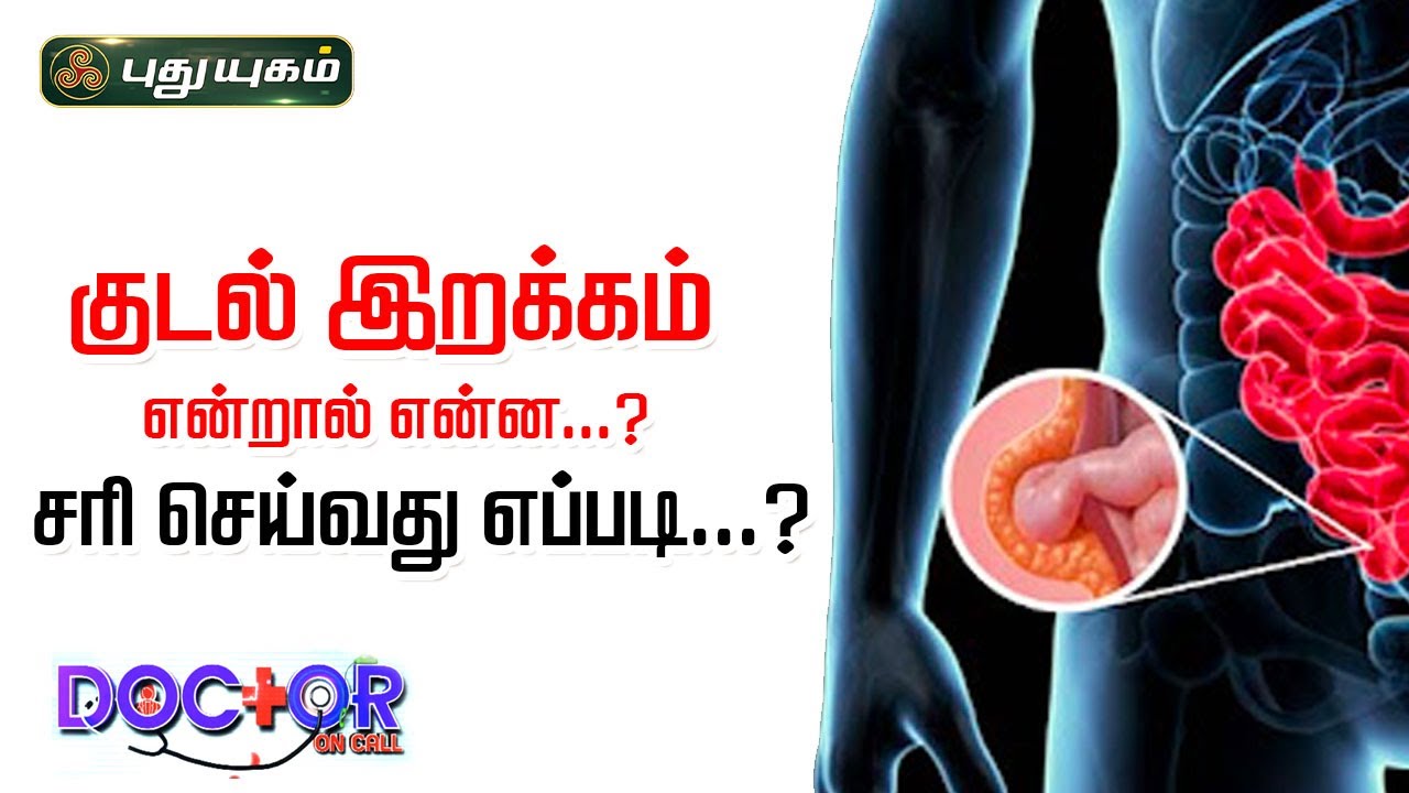 குடல் இறக்கம் என்றால் என்ன? சரி செய்வது எப்படி? Dr.Saravanan Vedhagiri #Doctor On Call #puthuyugamtv