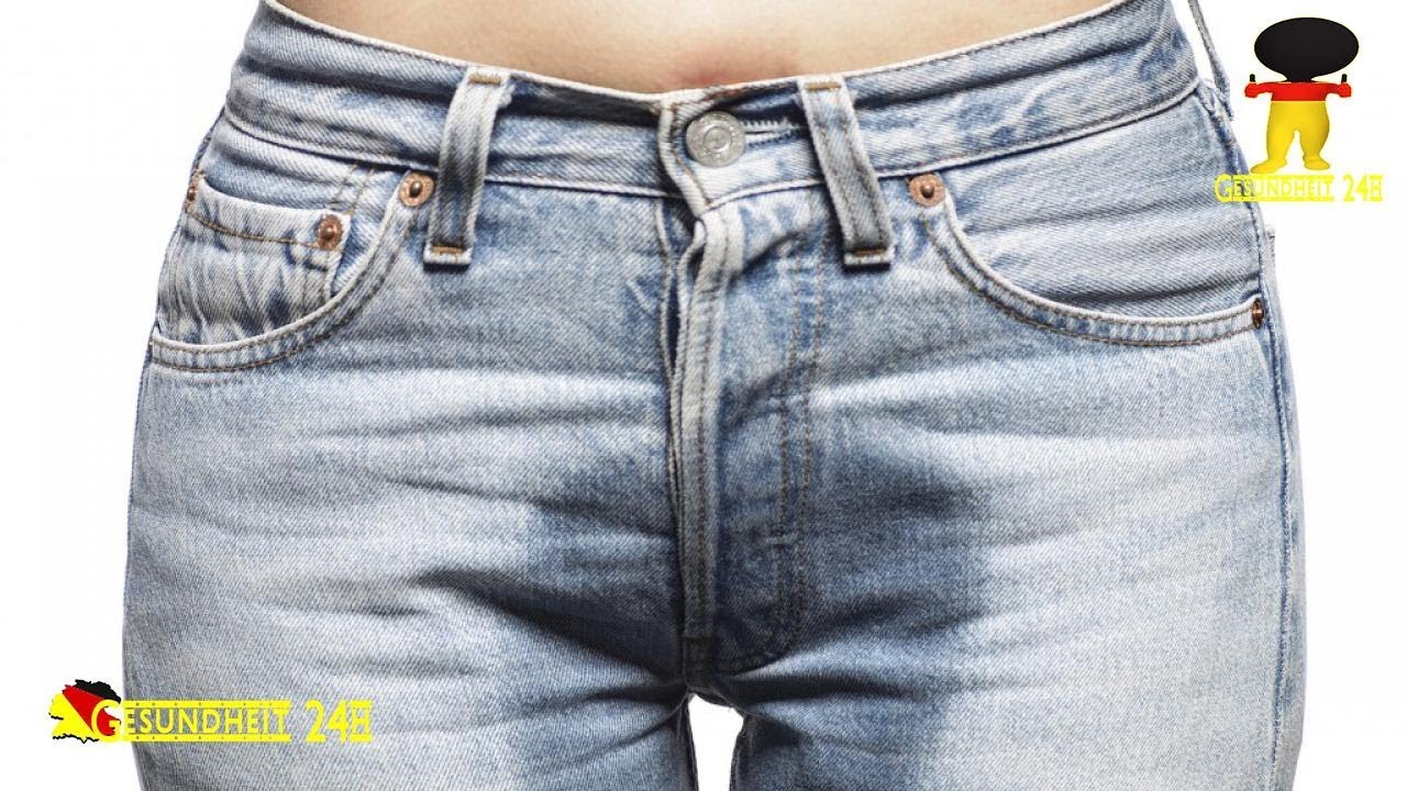 Stuhlinkontinent &ndash; was tun?