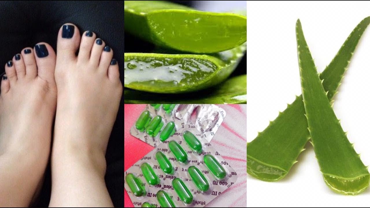 Make Your Hands & Feet Beautiful And Soft With Aloe Vera!! DIY Remedies.