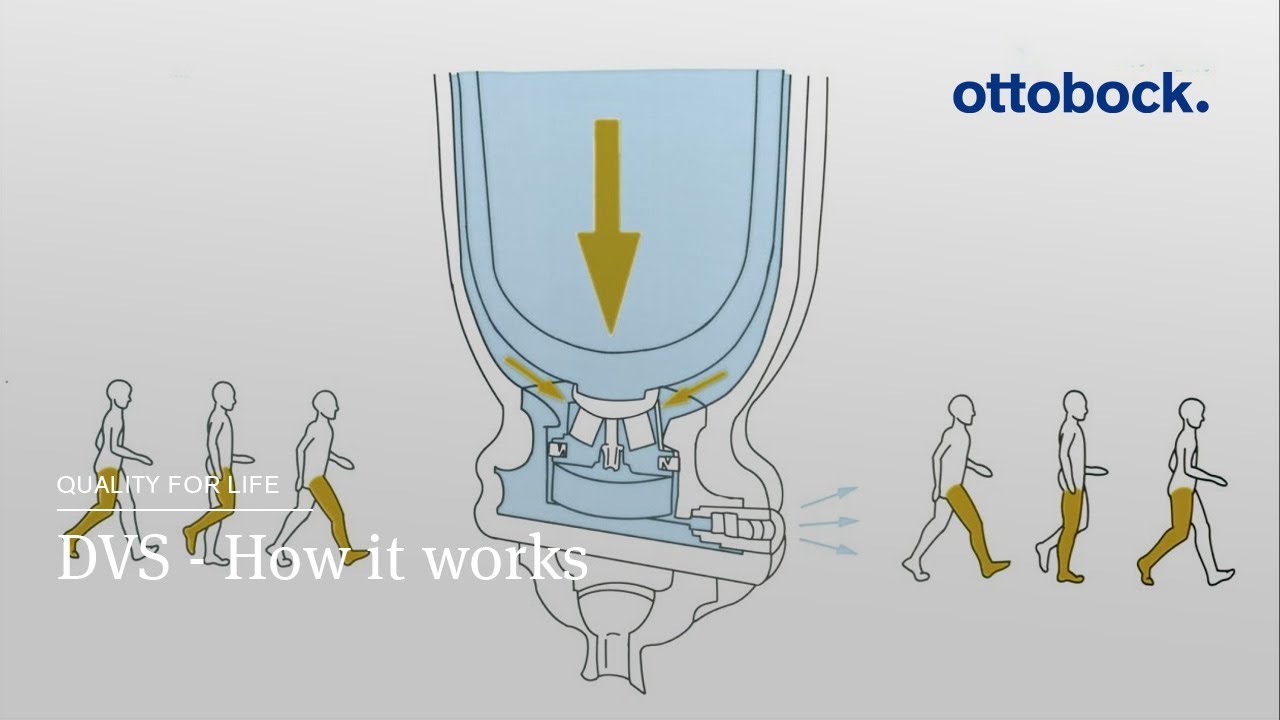 Dynamic Vacuum System (DVS) – How it works | Ottobock