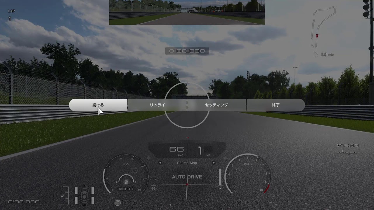 [GT7] 抜髄 (いいかげんにやっていきますわよとよむ)