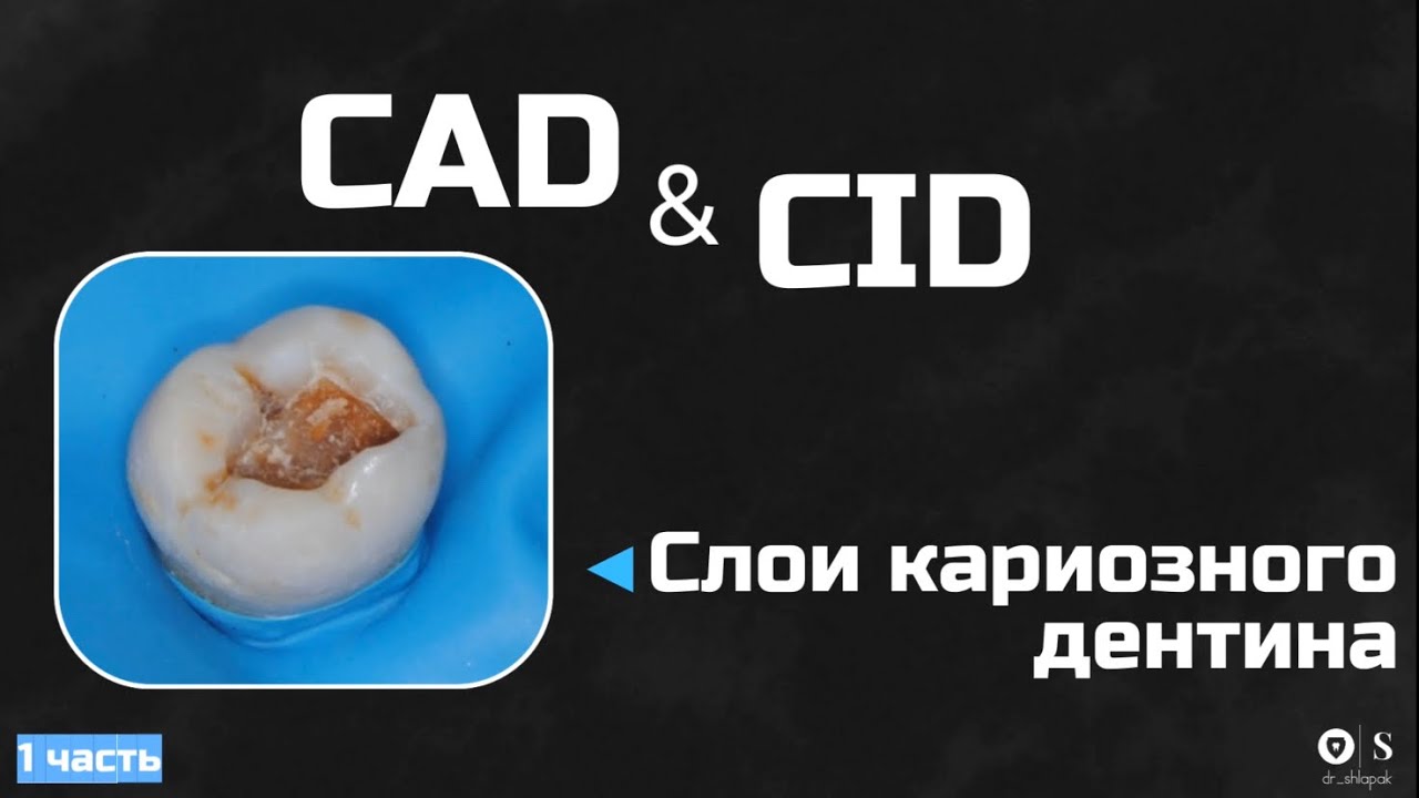 Слои кариозного дентина. CAD&CID(1часть)