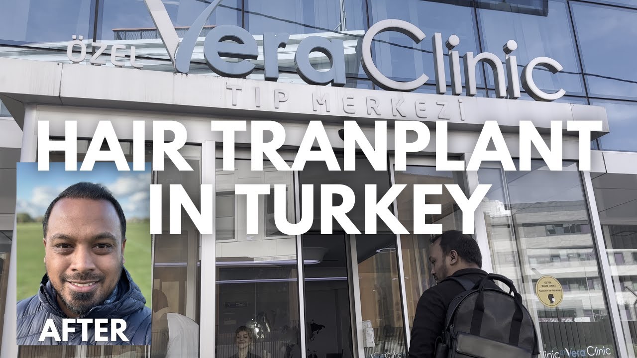 HAIR TRANSPLANT IN TURKEY - VERA CLINIC Full Breakdown & Thoughts