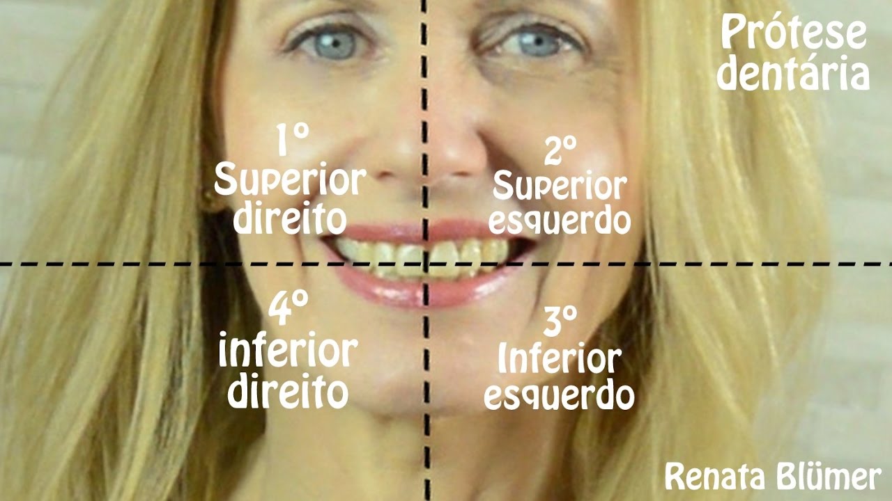 QUADRANTES: SUPERIOR E INFERIOR, DIREITO E ESQUERDO - PRÓTESE DENTÁRIA *