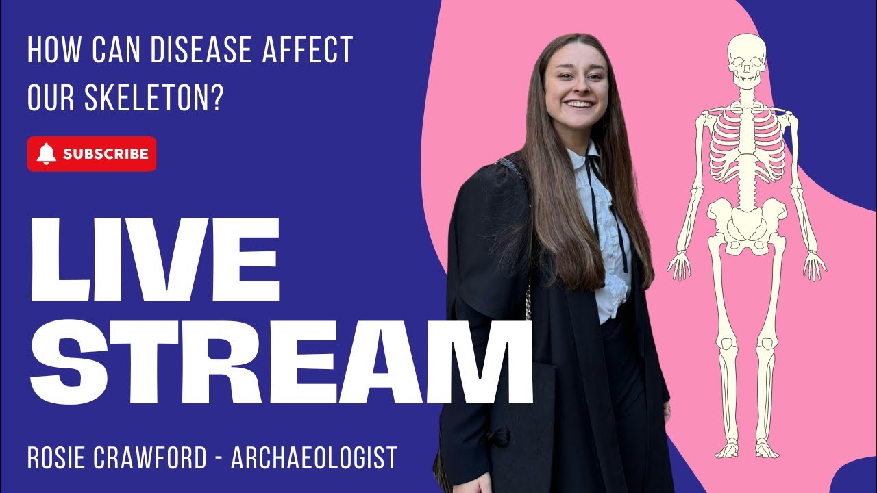 How do smallpox and other illnesses affect the human skeleton? LIVE w/ Rosie Crawford