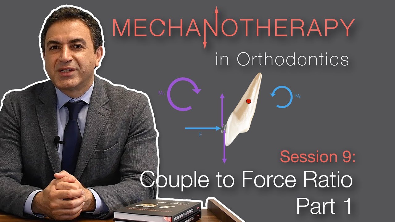 Mechanotherapy in Orthodontics: Couple to Force Ratio Pt. 1