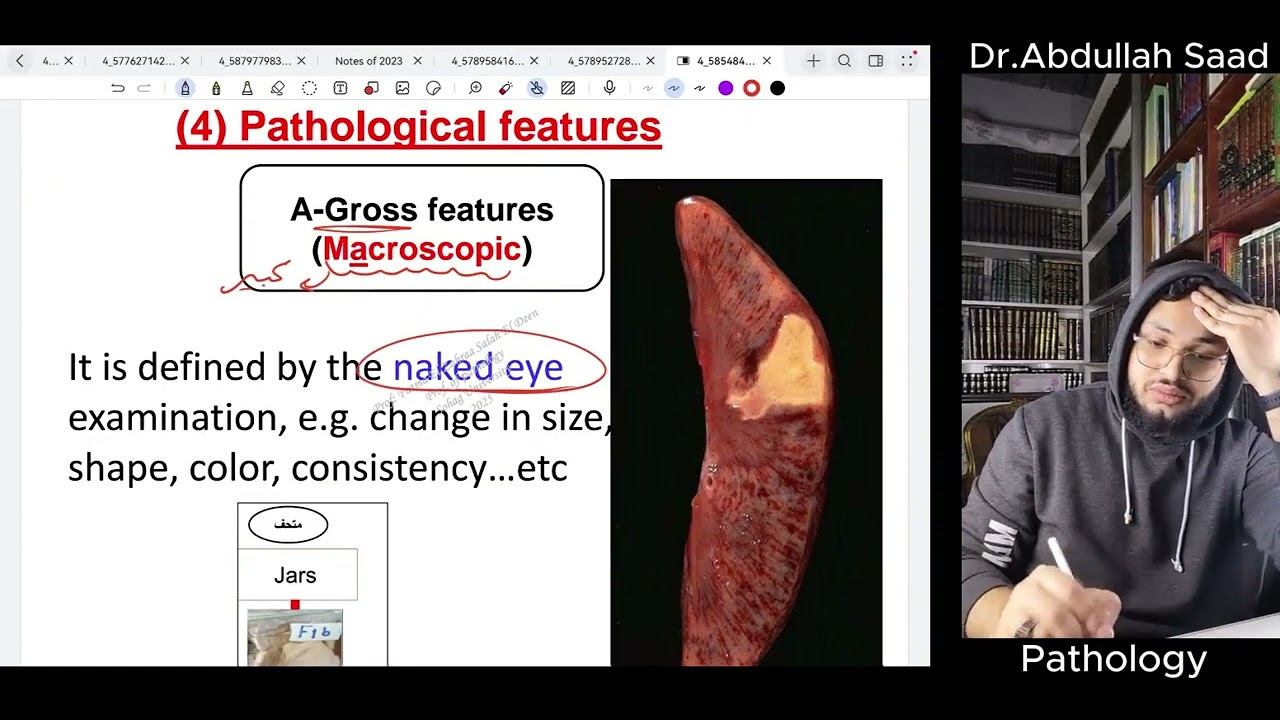 Pathology 1 SU