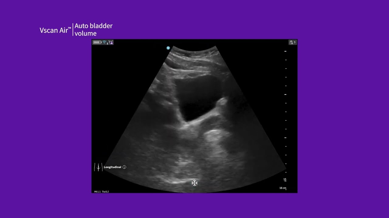 Vscan Air™ Product Tutorial | Auto Bladder Volume