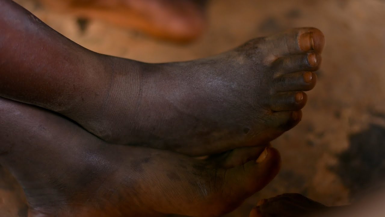 Homelessness and street life in Uganda (Documentary)
