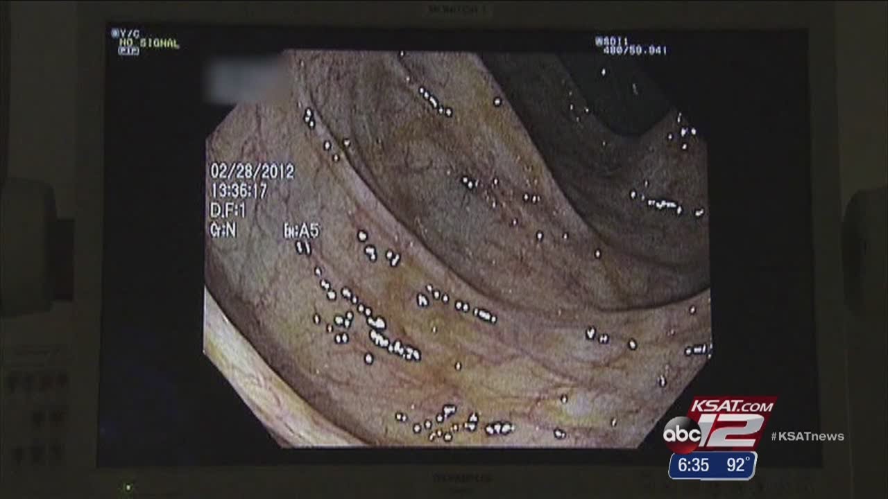 Fixing Flat Polyps