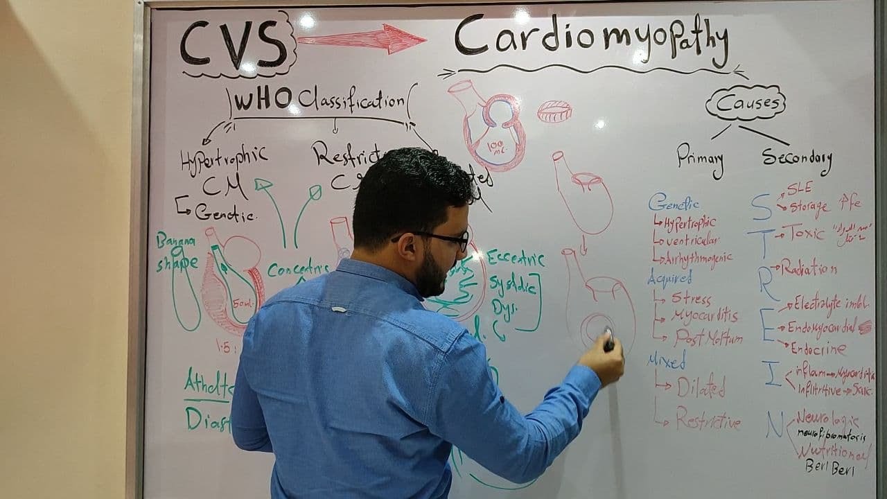 CVS MODULE - Cardiomyopathy and Cardiac Tumors