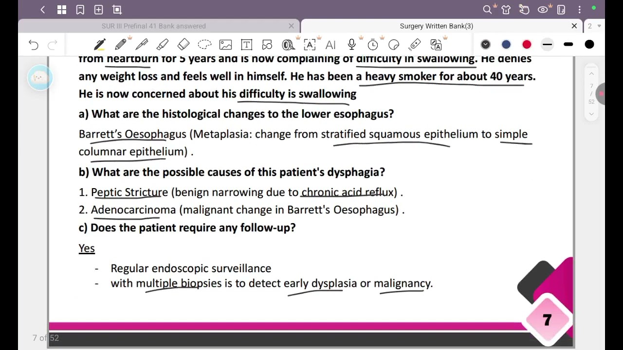Surgery written (Esophagus and Stomach)